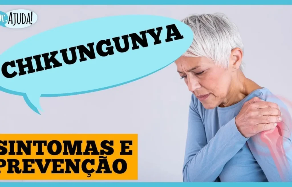 chikungunya:-dor-nas-articulacoes-que-pode-durar-meses
