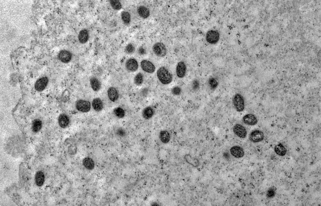 mpox:-sao-paulo-confirma-segundo-caso-da-doenca-pela-nova-cepa-clado-ib