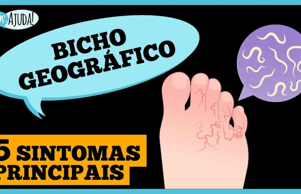 coceira-intensa-nos-pes-ou-nadegas?-pode-ser-bicho-geografico