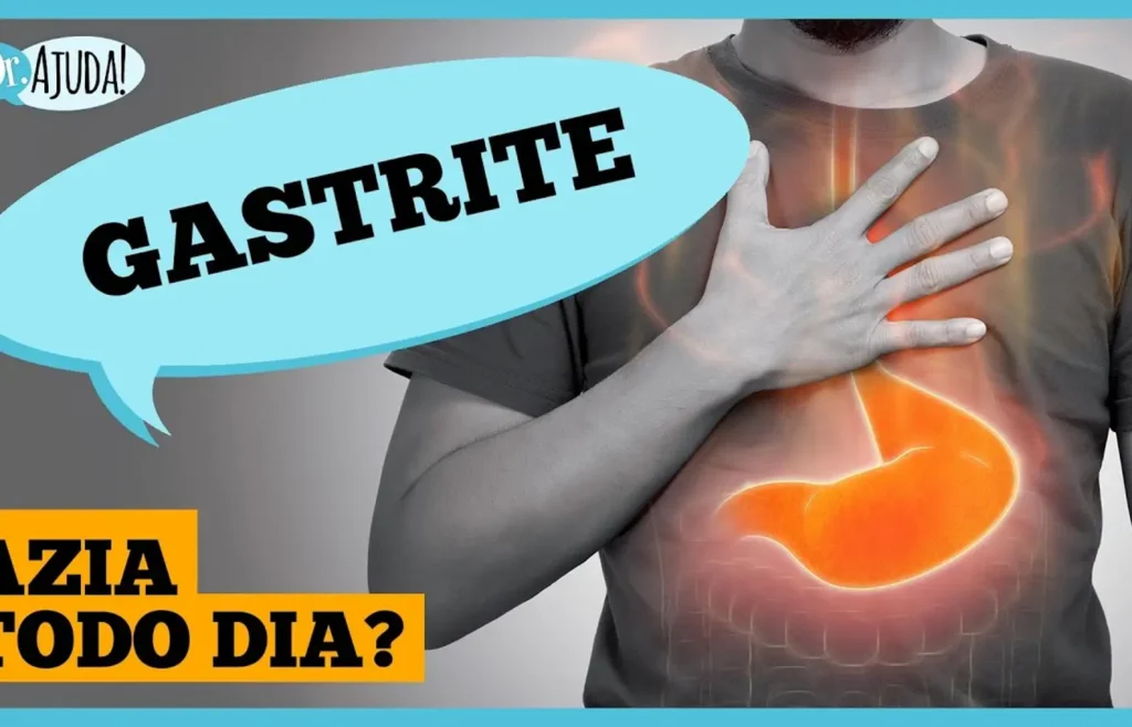 gastrite:-sintomas,-causas-e-tratamento