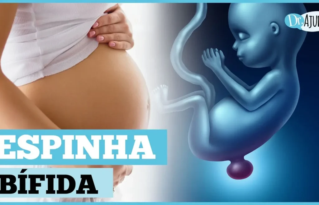 o-que-e-e-como-prevenir-a-mielomeningocele?