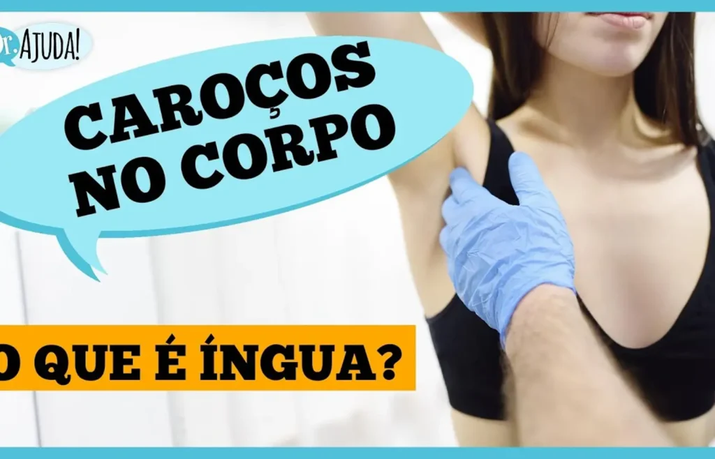 ingua-no-pescoco,-axila-ou-virilha?-entenda-o-que-pode-ser